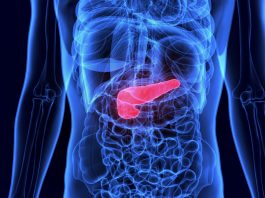Tumore al pancreas: i ricercatori chiedono l’uso compassionevole in Italia per il daraxonrasib