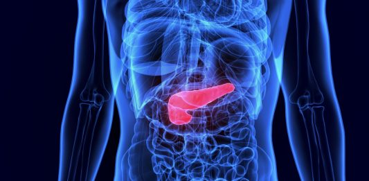 Tumore al pancreas: i ricercatori chiedono l’uso compassionevole in Italia per il daraxonrasib