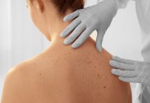 Melanoma: la nuova mappa cellulare permette di prevedere chi risponderà all’immunoterapia