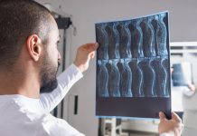 Un neurostimolatore migliora movimento e funzioni corporee a seguito di lesioni al midollo colonna vertebrale