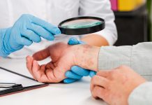 Per i problemi della pelle, 8 su 10 chiedono aiuto in rete