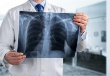 Cancro polmone e pancreas: smascherati i mutaforma nemici delle terapie