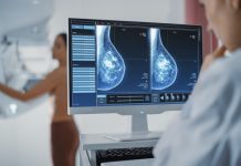 L’IA affianca i radiologi nella lettura delle mammografie