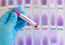 Nuova sperimentazione di terapia genica per la beta-talassemia