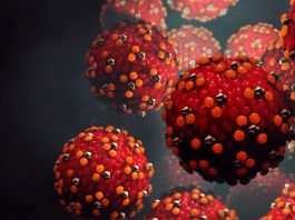 Morbillo, in Italia 472 casi confermati nei primi cinque mesi del 2026. Decisivo il ruolo del laboratorio