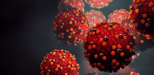 Morbillo, in Italia 472 casi confermati nei primi cinque mesi del 2026. Decisivo il ruolo del laboratorio