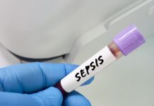 Sepsi, perché il tempo può fare la differenza: i segnali da non ignorare
