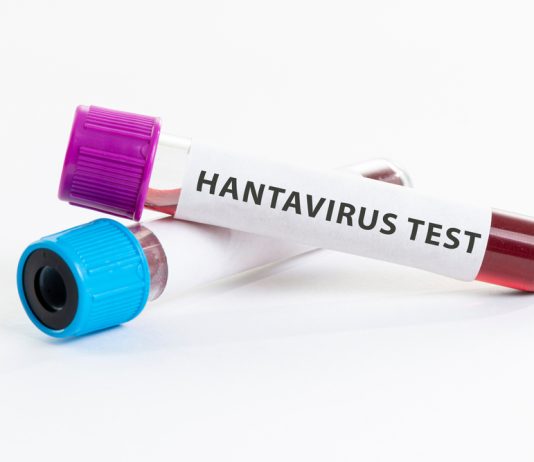 Hantavirus: attivata la sorveglianza attiva in Italia. Il punto sulla situazione e il ruolo della prevenzione