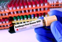 Virus Bundibugyo, parte la sperimentazione clinica sui primi possibili trattamenti